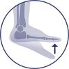 Correzione biomeccanica