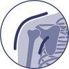 Immobilizzazione