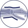 Immobilizzazione